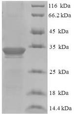 Human Dysbindin domain-containing protein 2 (DBNDD2) Recombinant Protein, Homo sapiens (Human), E.coli, N-terminal 6xHis-SUMO-tagged, 33.5 kDa, purity >≥ 90% as determined by SDS-PAGE.