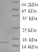 Human Eukaryotic translation initiation factor 4E-binding protein 2 (EIF4EBP2) Recombinant Protein, N-His - BioCrest Sci
