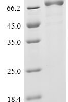 Human Interleukin-12 receptor subunit beta-2 (IL12RB2), partial Recombinant Protein, C-10His, aa 24–622 - BioCrest Sci