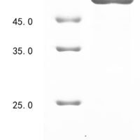 Human Tubulin beta-2A chain (TUBB2A) Recombinant Protein, N-10His - BioCrest Sci