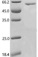 Human UDP-glucuronosyltransferase 1A1 (UGT1A1), partial Recombinant Protein - BioCrest Sci