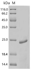 Human Neurotrophic factor BDNF precursor form (BDNF) Recombinant Protein, N-His, Homo sapiens (Human), E.coli, N-terminal 6xHis-tagged, 20.4 kDa, purity >≥ 85% as determined by SDS-PAGE.