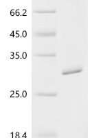 Escherichia coli RNA polymerase-binding transcription factor DksA (dksA) Recombinant Protein - BioCrest Sci