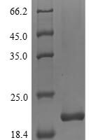 Human Myelin protein P0 (MPZ), partial Recombinant Protein, N-His - BioCrest Sci