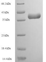 Crotalus adamanteus Thrombin-like enzyme crotalase (SVTLE) Recombinant Protein - BioCrest Sci
