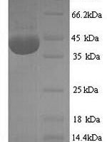 Rat NADPH oxidase 4 (Nox4), partial Recombinant Protein, N-His - BioCrest Sci