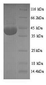 Rat NADPH oxidase 4 (Nox4), partial Recombinant Protein, N-His, Rattus norvegicus (Rat), Yeast, N-terminal 6xHis-tagged, 40.6 kDa, purity >≥ 90% as determined by SDS-PAGE.