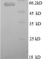 Human SPARC (SPARC) Recombinant Protein - BioCrest Sci