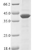 Methanobacterium ivanovii Nitrogenase iron protein 1 (nifH1) Recombinant Protein - BioCrest Sci