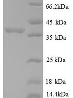 Human 60S acidic ribosomal protein P2 (RPLP2), partial Recombinant Protein - BioCrest Sci