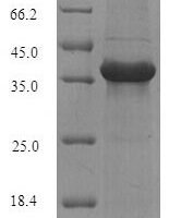 Mouse Alpha/beta hydrolase domain-containing protein 11 (Abhd11) Recombinant Protein - BioCrest Sci