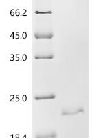 Rat Inhibin beta E chain (Inhbe) Recombinant Protein - BioCrest Sci