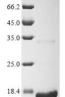 Porcine reproductive and respiratory syndrome virus Nucleoprotein (N) Recombinant Protein, C-His, aa 1–128 - BioCrest Sci
