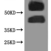 Human N-formyl peptide receptor 2 (FPR2)-VLPs Recombinant Protein - BioCrest Sci