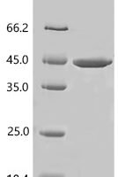 Human Growth hormone-releasing hormone receptor (GHRHR), partial Recombinant Protein - BioCrest Sci