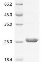 Micrococcus luteus Large ribosomal subunit protein bL12 (rplL) Recombinant Protein - BioCrest Sci