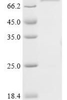 Vaccinia virus Ankyrin repeat protein OPG025 (OPG035) Recombinant Protein - BioCrest Sci