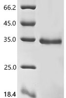 Mouse Epithelial cell adhesion molecule (Epcam), partial Recombinant Protein, N-10His/C-Myc - BioCrest Sci