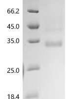 Human Transcriptional enhancer factor TEF-5 (TEAD3), partial Recombinant Protein, N-Twin-Strep/C-His - BioCrest Sci
