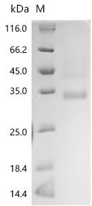 Human Transcriptional enhancer factor TEF-5 (TEAD3), partial Recombinant Protein, N-Twin-Strep/C-His, Homo sapiens (Human), Yeast, N-terminal Twin-Strep-tagged and C-terminal 6xHis-tagged, 40.8 kDa, purity >≥ 95% as determined by SDS-PAGE.