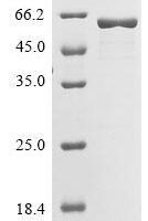 Arabidopsis thaliana Allene oxide synthase, chloroplastic (CYP74A) Recombinant Protein - BioCrest Sci