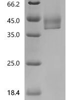 Dog Lipocalin Can f 6.0101 Recombinant Protein, N-His-SUMOstar - BioCrest Sci