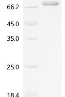 Human Suppressor of cytokine signaling 6 (SOCS6) Recombinant Protein, N-10His - BioCrest Sci
