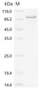 Human Suppressor of cytokine signaling 6 (SOCS6) Recombinant Protein, N-10His, Homo sapiens (Human), E.coli, N-terminal 10xHis-tagged, 65.6 kDa, purity >≥ 85% as determined by SDS-PAGE.