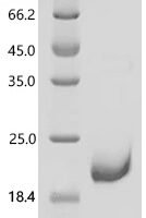 Human Small proline-rich protein 2A (SPRR2A) Recombinant Protein - BioCrest Sci