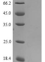 Human Interleukin-8 (CXCL8) Recombinant Protein - BioCrest Sci