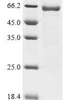 Human metapneumovirus Matrix protein (M) Recombinant Protein, C-hFc1 - BioCrest Sci
