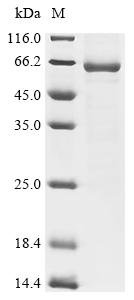 Human metapneumovirus Matrix protein (M) Recombinant Protein, C-hFc1, Human metapneumovirus (strain CAN97-83) (HMPV), Mammalian cell, C-terminal hFc1-tagged, 56.5 kDa, purity >≥ 85% as determined by SDS-PAGE.