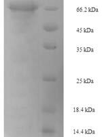 Mouse Pancreatic secretory granule membrane major glycoprotein GP2 (Gp2) Recombinant Protein, N-His-SUMO - BioCrest Sci