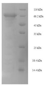 Mouse Pancreatic secretory granule membrane major glycoprotein GP2 (Gp2) Recombinant Protein, N-His-SUMO, Mus musculus (Mouse), E.coli, N-terminal 6xHis-SUMO-tagged, 73.0 kDa, purity >≥ 90% as determined by SDS-PAGE.