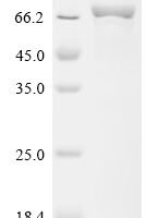 Human 4-aminobutyrate aminotransferase, mitochondrial (ABAT) Recombinant Protein - BioCrest Sci