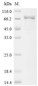 Human 4-aminobutyrate aminotransferase, mitochondrial (ABAT) Recombinant Protein, Homo sapiens (Human), E.coli, N-terminal GST-tagged, 79.9 kDa, purity >≥ 85% as determined by SDS-PAGE.