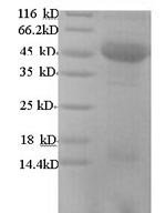 Human m7GpppN-mRNA hydrolase (DCP2) Recombinant Protein, Homo sapiens (Human), Yeast, N-terminal 6xHis-tagged, 46.4 kDa, purity >≥ 90% as determined by SDS-PAGE.