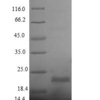 Streptomyces hygroscopicus Phosphinothricin N-acetyltransferase (bar) Recombinant Protein - BioCrest Sci