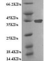 Mouse Clathrin light chain A (Clta) Recombinant Protein, N-His/Flag - BioCrest Sci