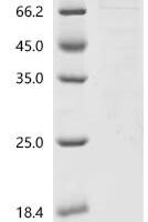 Human Signal transducer and activator of transcription 6 (STAT6), partial Recombinant Protein - BioCrest Sci