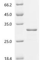 Ananas comosus Fruit bromelain Recombinant Protein - BioCrest Sci
