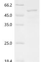 Glutamicibacter nicotianae Adenylate cyclase (cya)(D403A) Recombinant Protein - BioCrest Sci