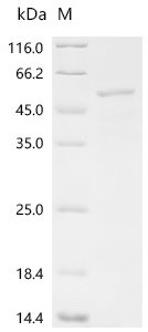 Glutamicibacter nicotianae Adenylate cyclase (cya)(D403A) Recombinant Protein, Glutamicibacter nicotianae (Arthrobacter nicotianae), E.coli, C-terminal 6xHis-tagged, 50.8 kDa, purity >≥ 85% as determined by SDS-PAGE.