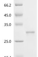Human Erythropoietin (EPO) Recombinant Protein, C-His - BioCrest Sci