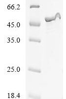 Shigella flexneri Long-chain fatty acid transport protein (fadL) Recombinant Protein - BioCrest Sci