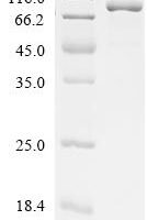 Escherichia coli Threonine--tRNA ligase (thrS) Recombinant Protein - BioCrest Sci