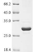 Human Phosphatidylinositol 4,5-bisphosphate 3-kinase catalytic subunit alpha isoform (PIK3CA), partial Recombinant Protein - BioCrest Sci