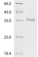 Coxiella burnetii LPS-assembly protein lptD (lptD), partial Recombinant Protein - BioCrest Sci