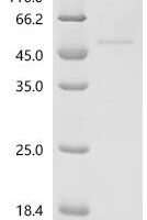 Human Glycogen synthase kinase-3 beta (GSK3B) Recombinant Protein, C-His - BioCrest Sci
