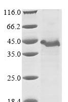 Human A disintegrin and metalloproteinase with thrombospondin motifs 9 (ADAMTS9), partial Recombinant Protein - BioCrest Sci